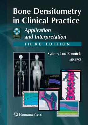 Bone Densitometry in Clinical Practice