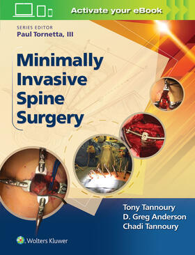 Minimally Invasive Spine Surgery