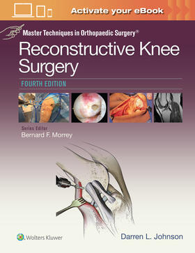 Master Techniques in Orthopaedic Surgery: Reconstructive Kne