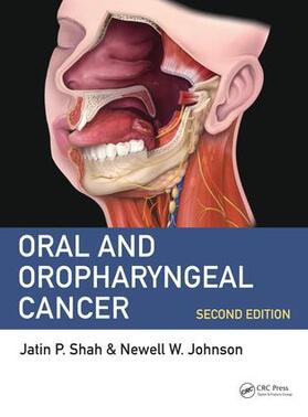 Shah, J: Oral and Oropharyngeal Cancer