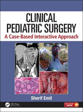 Clinical Pediatric Surgery