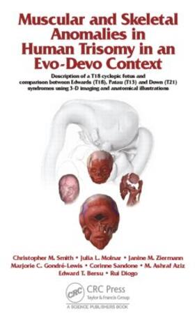 Muscular and Skeletal Anomalies in Human Trisomy in an Evo-Devo Context