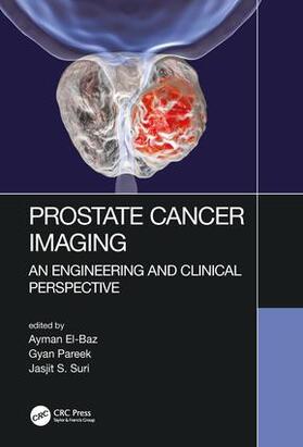 Prostate Cancer Imaging