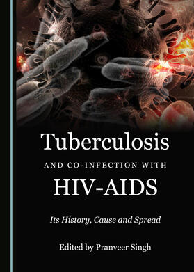 Tuberculosis and Co-infection with HIV-AIDS