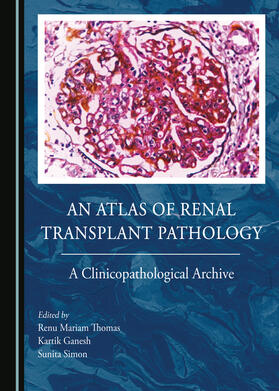 An Atlas of Renal Transplant Pathology