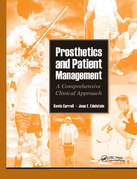 Prosthetics and Patient Management