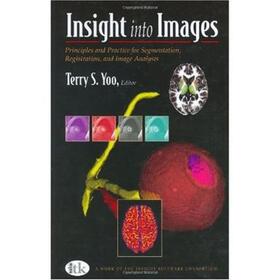 Insight into Images