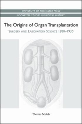 Origins of Organ Transplantation