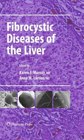 Fibrocystic Diseases of the Liver