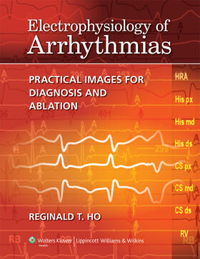 Electrophysiology of Arrhythmias