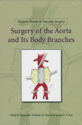 Modern Trends in Vascular Surgery: Surgery of the Aorta and its Body Branches