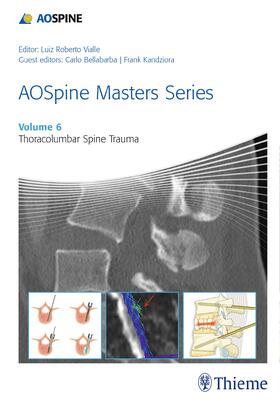 AOSPINE MASTERS SERIES V06 THO