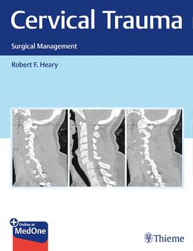 Cervical Trauma