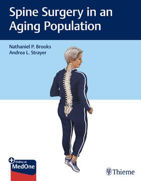 Spine Surgery in an Aging Population