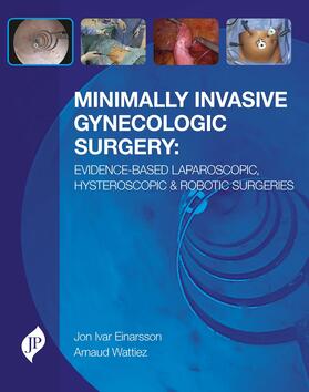 Minimally Invasive Gynecologic Surgery: Evidence-Based Laparoscopic, Hysteroscopic & Robotic Surgeries