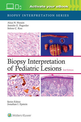 Husain, A: Biopsy Interpretation of Pediatric Lesions