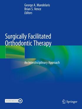 Surgically Facilitated Orthodontic Therapy