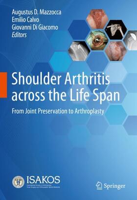 Shoulder Arthritis across the Life Span