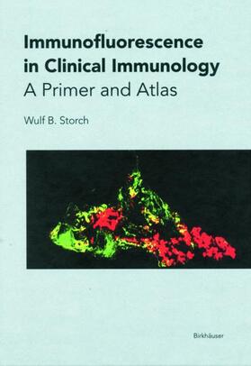 Immunofluorescence in Clinical Immunology