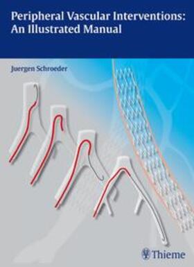 Schröder, J: Peripheral Vascular Interventions