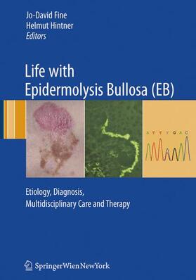 Life with Epidermolysis Bullosa (EB)