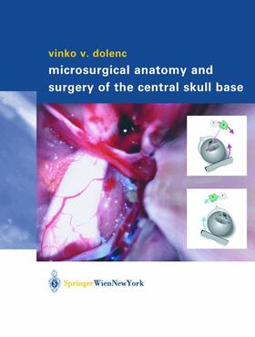 Microsurgical Anatomy and Surgery of the Central Skull Base