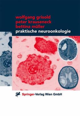 Praktische Neuroonkologie