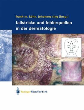 Fallstricke und Fehlerquellen in der Dermatologie