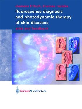 Fluorescence Diagnosis and Photodynamic Therapy of Skin Diseases