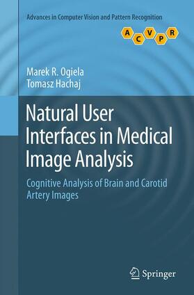 Natural User Interfaces in Medical Image Analysis