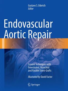 Endovascular Aortic Repair