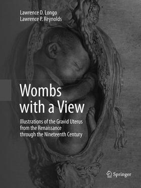 Wombs with a View