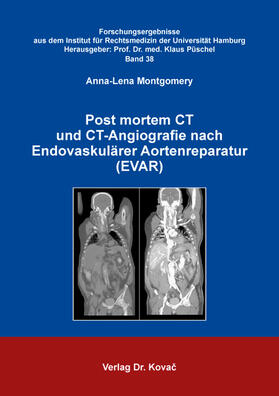 Post mortem CT und CT-Angiografie nach Endovaskulärer Aortenreparatur (EVAR)
