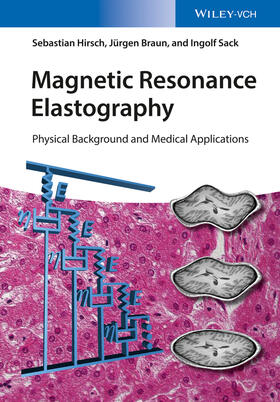 Hirsch, S: Magnetic Resonance Elastography