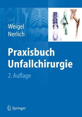 Praxisbuch Unfallchirurgie