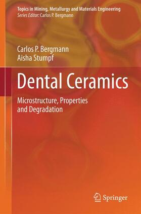 Dental Ceramics