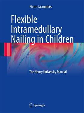 Flexible Intramedullary Nailing in Children