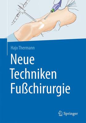 Neue Techniken Fußchirurgie