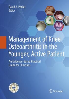 Management of Knee Osteoarthritis in the Younger, Active Patient