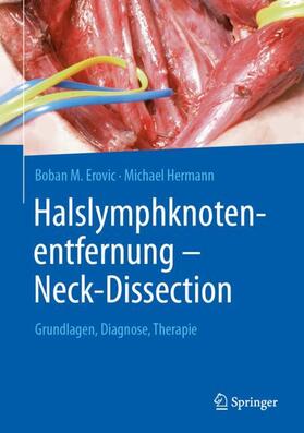 Halslymphknotenentfernung ¿ Neck-Dissection