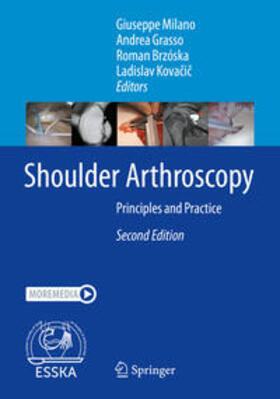 Shoulder Arthroscopy