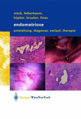 Endometriose