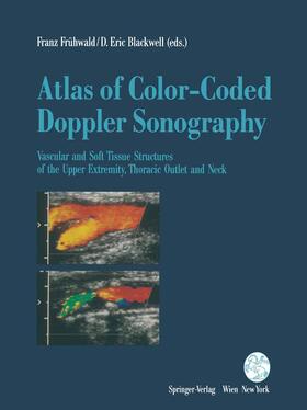 Atlas of Color-Coded Doppler Sonography