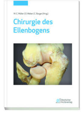 Chirurgie des Ellenbogens