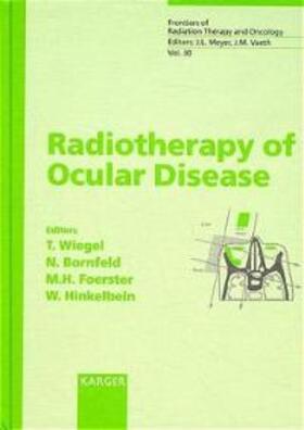 Radiotherapy of Ocular Diseases