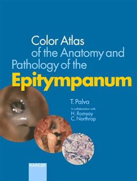 Color Atlas of the Anatomy and Pathology of the Epitympanum
