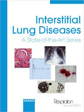 Interstitial Lung Diseases