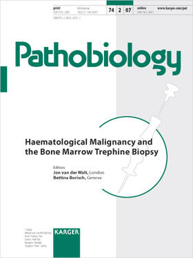 Haematological Malignancy and the Bone Marrow Trephine Biopsy
