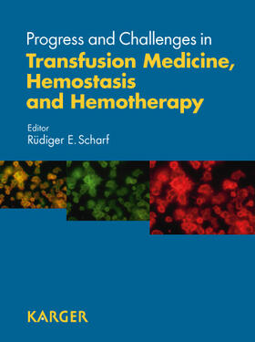 Progress and Challenges in Transfusion Medicine, Hemostasis,