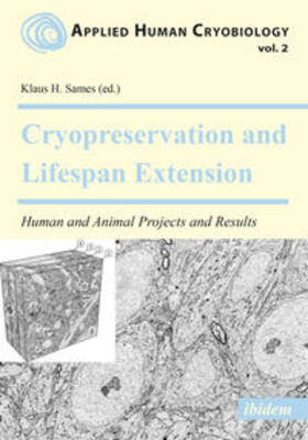 Cryopreservation and Lifespan Extension. Human and Animal Projects and Results